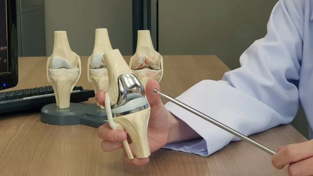 Fellowship In Orthopedics Arthroplasty